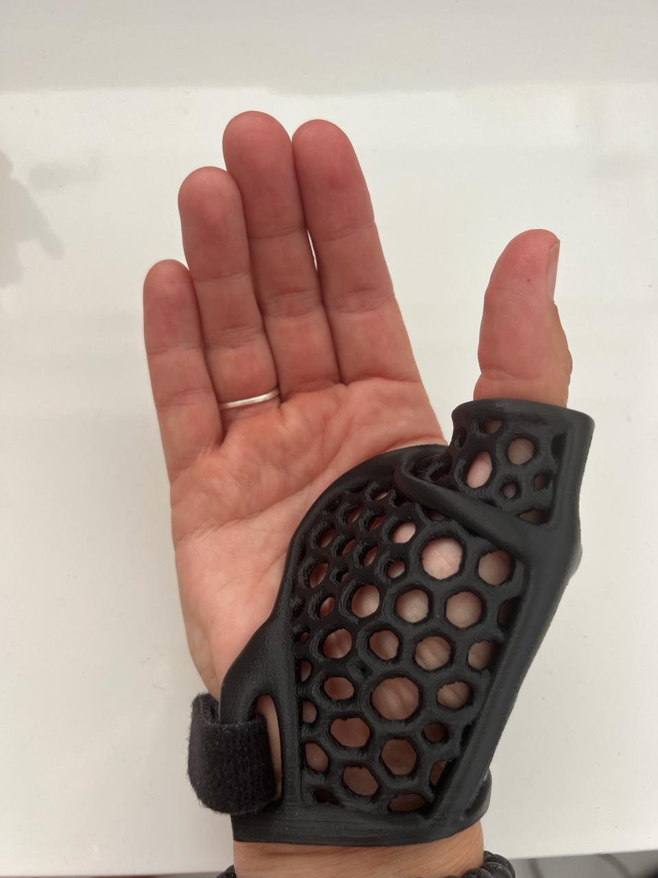 Attelle orthopédique de pouce imprimée en 3D, portée à la main
